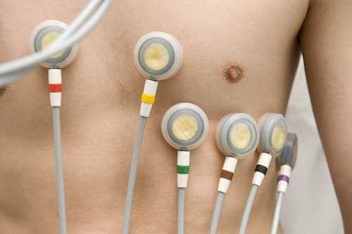 Электроды для ЭКГ в грудных отведениях