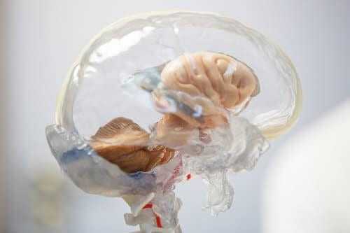Мозг с прозрачной корой полушарий