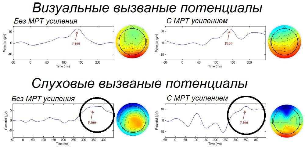 Моторные вызванные потенциалы