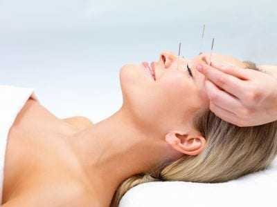 Beautiful young woman with eyes closed receiving Acupuncture therapy