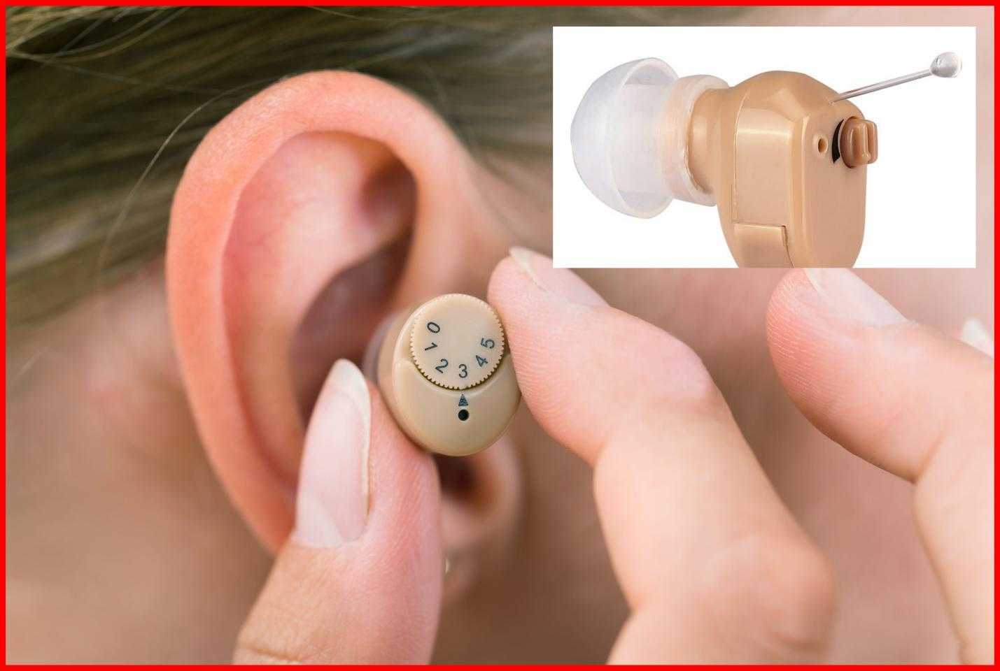 Как подобрать слуховой аппарат без врача. Acosound acomate 610if отзывы.
