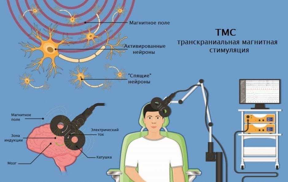 Картинки для эпилепсии