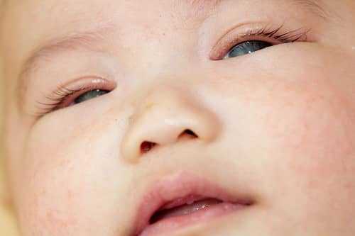 Застывшее лицо приступ эпилепсии у младенца