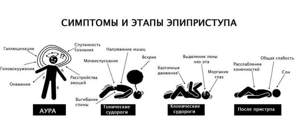 Карта вызова эпилепсия состояние после приступа