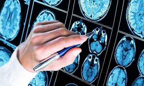 Поиск патологии мозга на МРТ