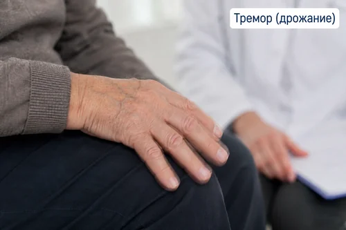 На первой стадии болезни Паркинсона дрожит одна рука Тремор одной руки первый признак болезни Паркинсона