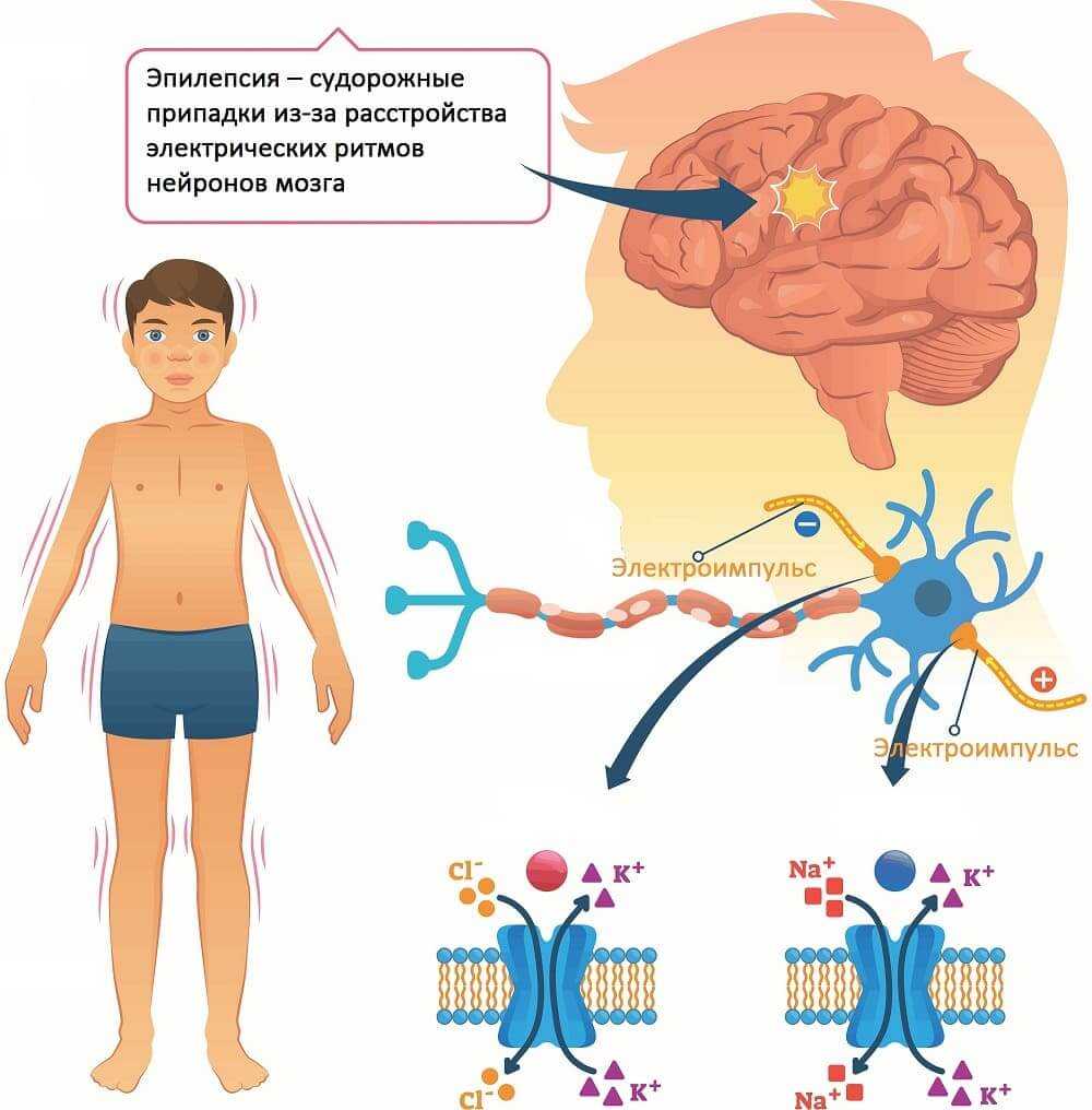 Может ли приступ эпилепсии быть один раз в жизни