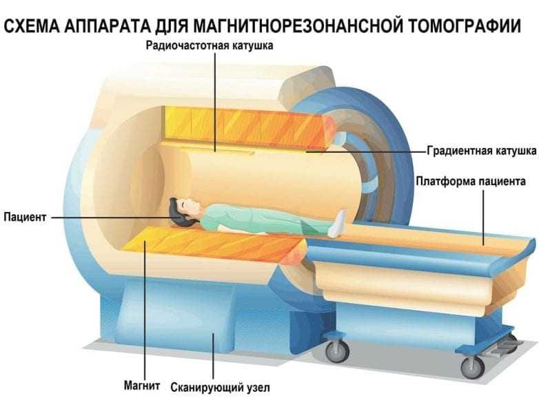 Устройство аппарата для МРТ
