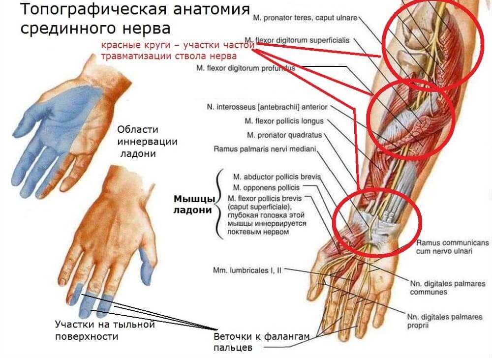 Анатомия и места развития компрессионной нейропатии срединного нерва