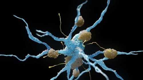 Изображение нейрона с бляшками амилоида