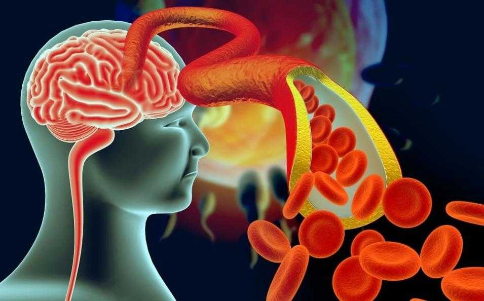 энцефалопатия мозг
