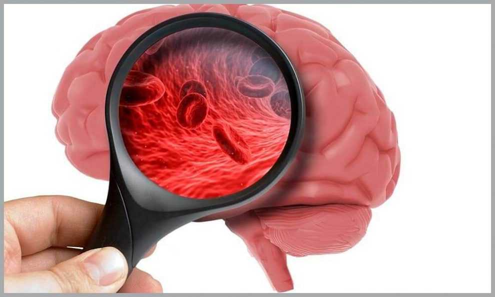 Дисциркуляторная энцефалопатия 1 степени. Определение симптомов и ...