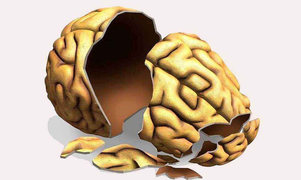 Посттравматическая энцефалопатия как разрушение мозга