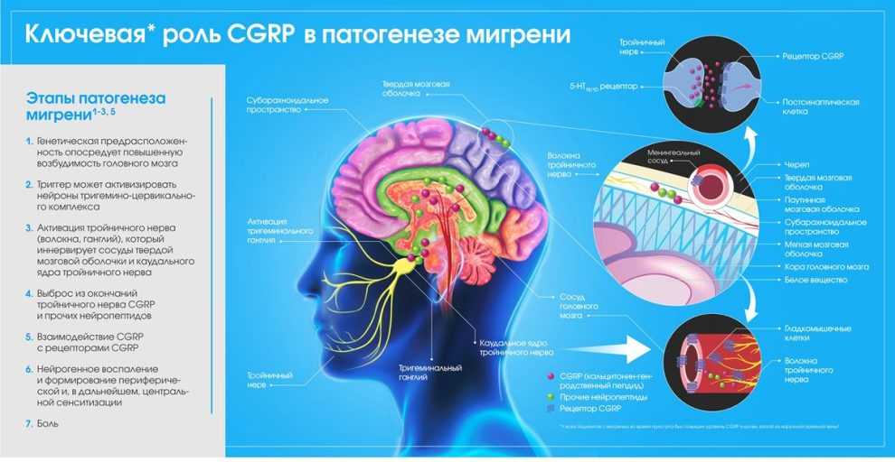 Лечение мигрени препаратами с моноклональными антителами - уколы против ...
