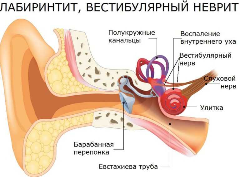 Причины головокружения. От чего постоянно сильно кружится голова.
