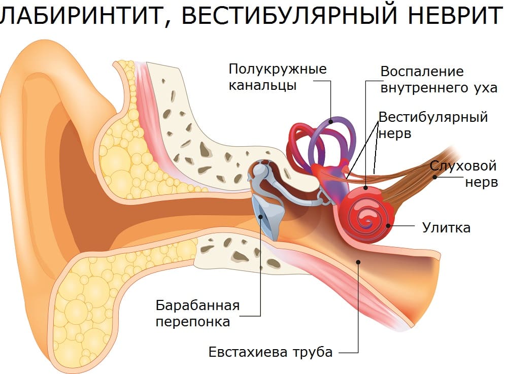 Инфекция внутреннего уха вызывает головокружение