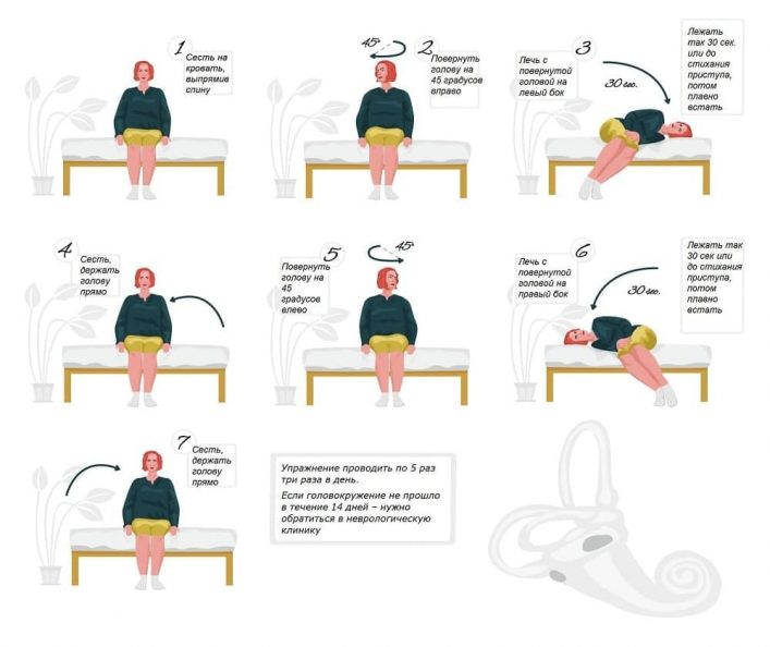 Маневр эпли при головокружении схема