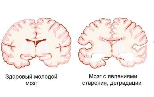 Процессы старения мозга
