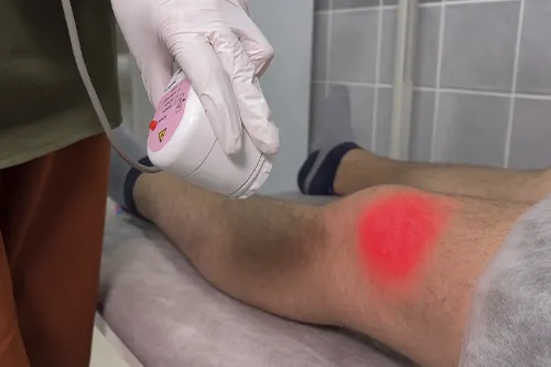 Ударно-волновая терапия и физиотерапия и мануальные техники